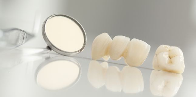 Tratamentul efectiv al cariei dentare la stomatologia Davinci dental clinic